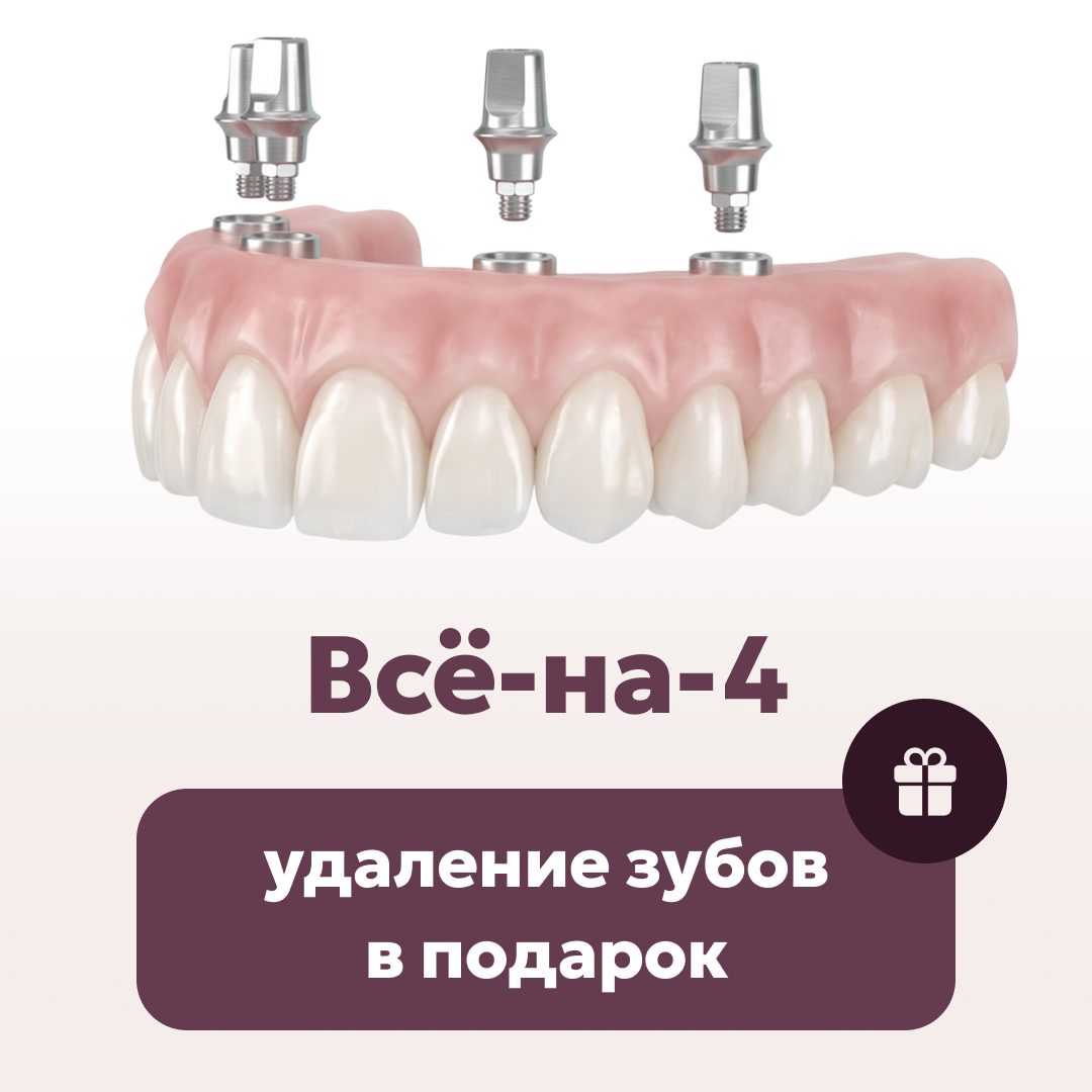 Всё-на-4: удаление зубов в подарок