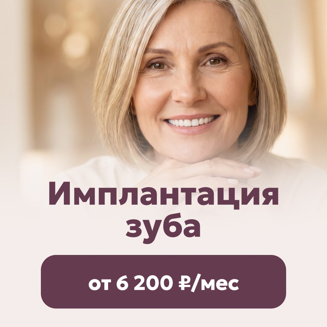 Имплантация зуба от 6 200 ₽/мес.