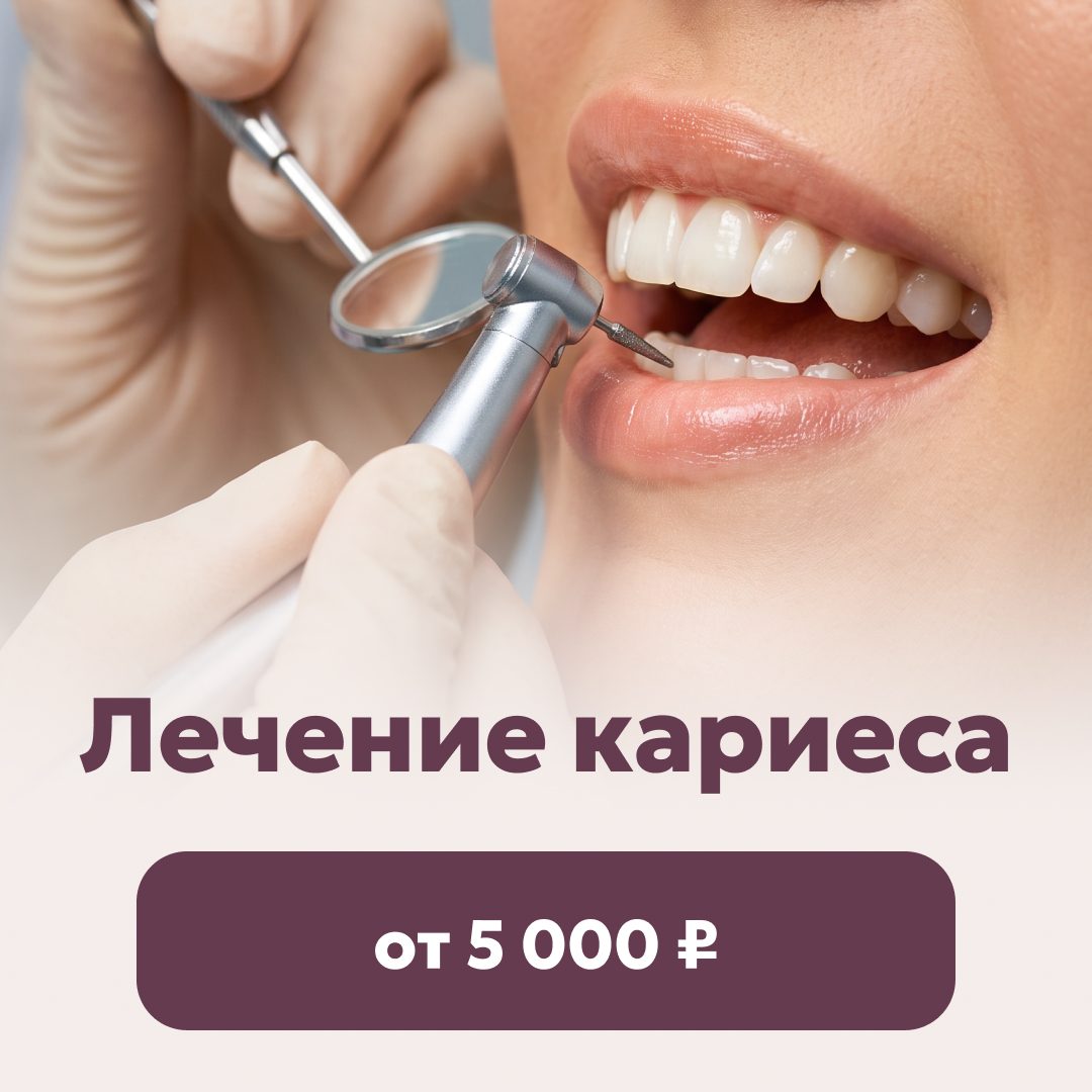 Лечение кариеса от 5 000 ₽